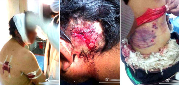 Images of Tibetans wounded